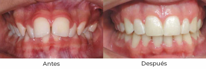 ortodoncia1