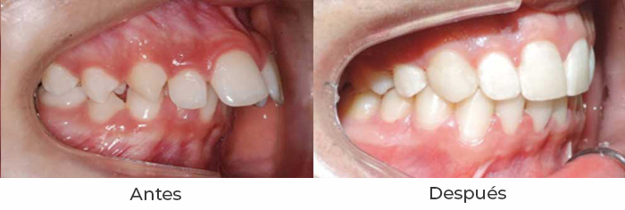 ortodoncia1b