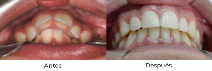 ortodoncia1c
