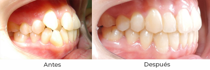 ortodoncia2c