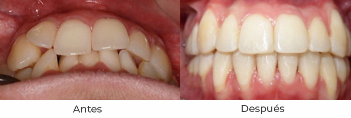ortodoncia4c
