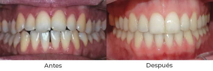ortodoncia6