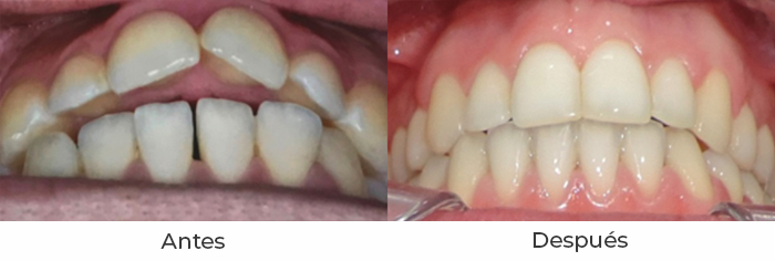 ortodoncia6c