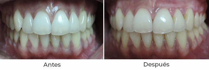 periodontal1