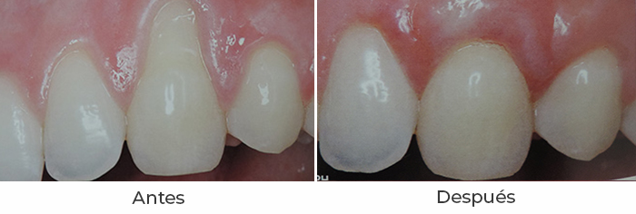 periodontal2